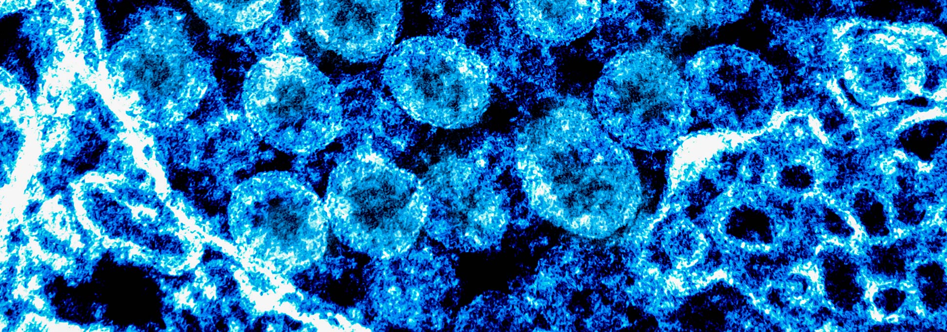 Transmission electron micrograph of SARS-CoV-2 virus